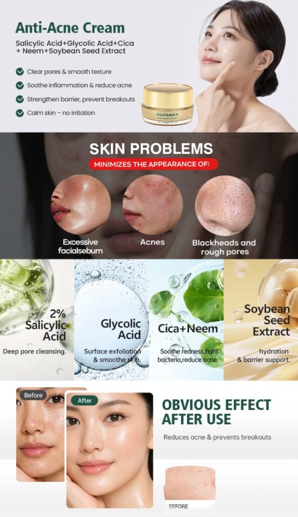 antiacne1